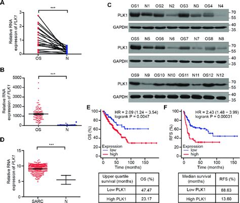 PLK1 Is Over Expressed In Osteosarcoma And Sarcoma And Higher PLK1