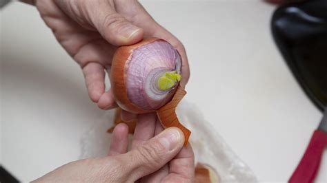 8 Surprising Benefits Of Onion Peels You Should Know | OnlyMyHealth