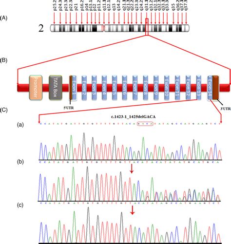 Sanger Sequence Chromatogram Of Dcaf17 The Upper Panel Shows The Download Scientific Diagram