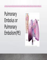 Understanding Pulmonary Embolism Risk Factors Mechanisms And