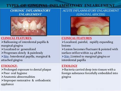 Gingival enlargement