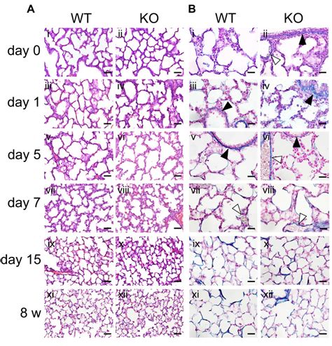 Development Of Aging Related Emphysematous And Lymphoma Like Lesions Is