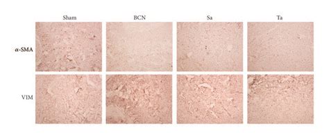 The Effect Of Salidroside On The Expression Of Corpora Cavernosum