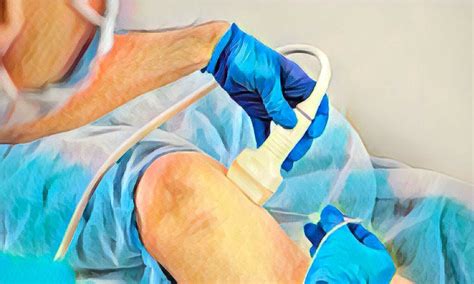 Rhizotomy | Expert Pain Relief at Pain Specialists WA