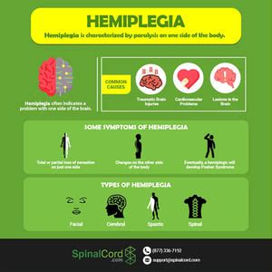 Living with Hemiplegia and Hemiparesis: Causes, Treatment + Coping