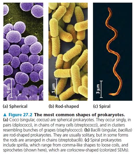 Eubacteria Kingdom Examples