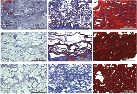 Histological Analyses And Masson’s Trichrome Staining Of Three Segments Download Scientific