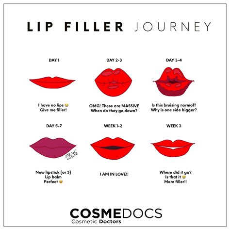 Ml Lip Filler Before And After Thin Lips Lipstutorial Org