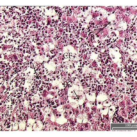 Photomicrograph Of A Section Of Liver Of Rat Obtained From Different