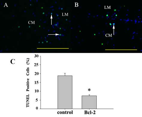 Bcl 2 Overexpression Decreases Cell Death Representative Pictures Of Download Scientific