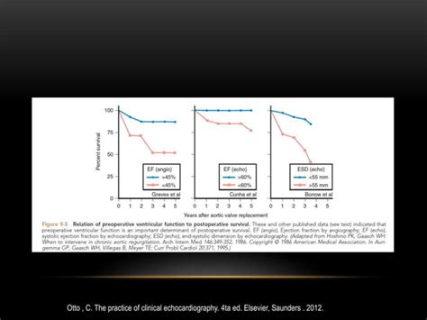 Función Ventricular Izquierda PPT Descarga gratuita