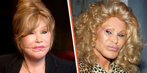 Jocelyn Wildenstein D Voile Son Vrai Visage Avant Ses Nombreuses