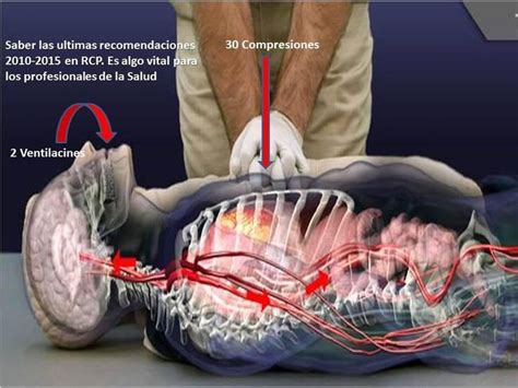 MANUALES GRATIS RCP BLS REANIMACION CARDIO PULMONAR BASICA Y AVANZADA