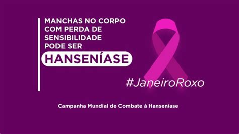 Evento Dia Nacional De Combate E Prevenção Da Hanseníase Rádio Cidade