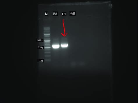 Agarose Gel Electrophoresis Showing Pcr Amplification Of Aspergillus