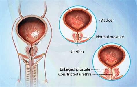 Health Condition Symptoms Causes Treatment And More