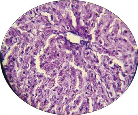 Photomicrograph Of The Liver Section Of Normal Rabbits No Abnormality