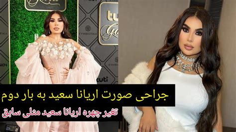 اریانا سعید با چهره جدید غوغا کرد و جراحی چشم های اریانا سعید مانند