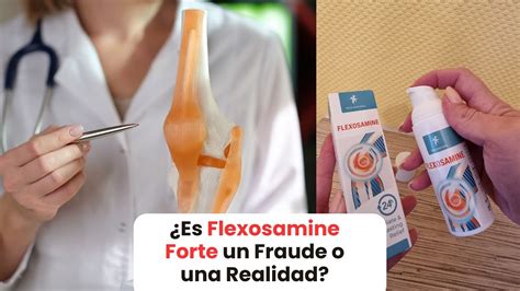 Flexosamine Forte Realmente Alivia El Dolor Articular Rese A