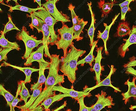 Cultured Hela Cells Light Micrograph Stock Image G4420321