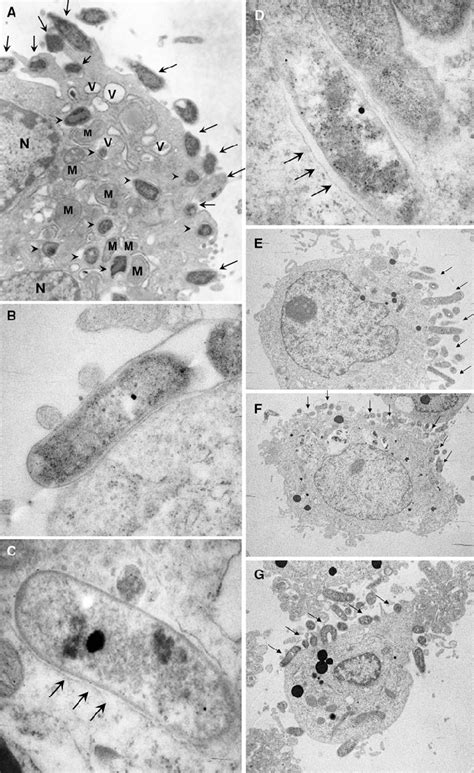 Transmission Electron Microscopy Tem Of H Pylori Nctc11637 Adhering