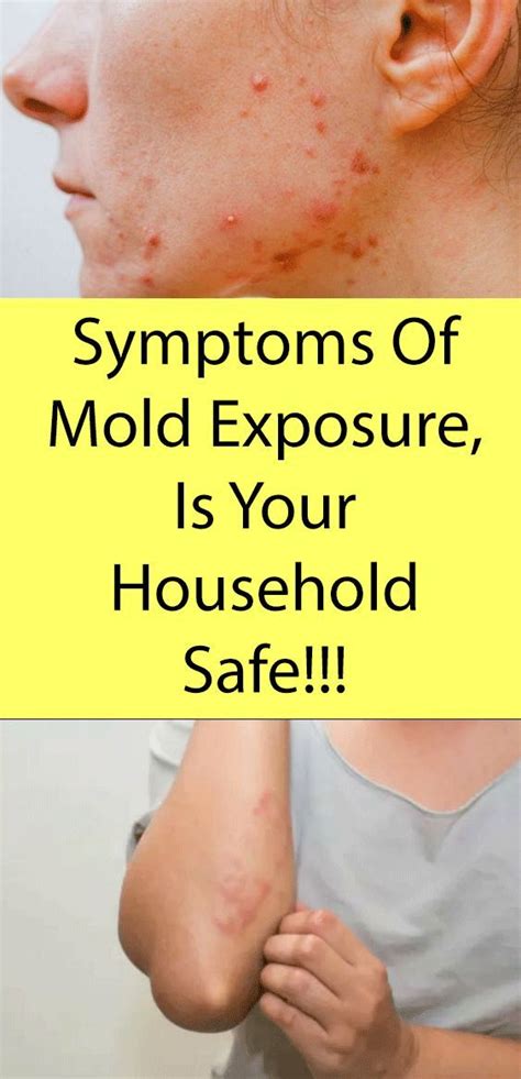 House With Mold Symptoms At Buford Bahena Blog