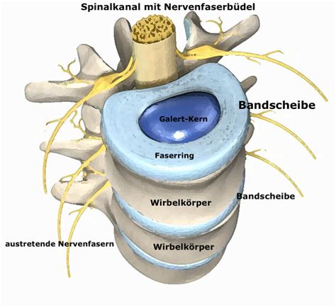 Bandscheibenvorfall Discusprolaps Osteopathie Wien Craniosakrale