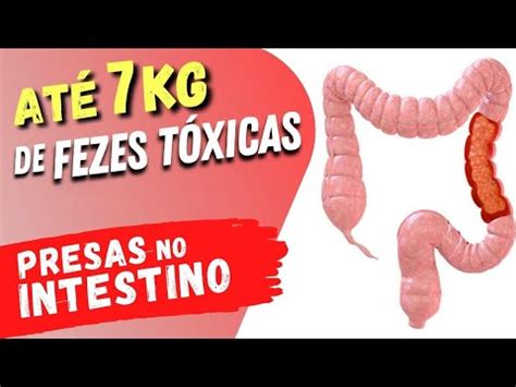 Fezes Presas No Intestino - Até 7 KG DE FEZES Tóxicas PRESAS No INTESTINO? Veja Isso!
