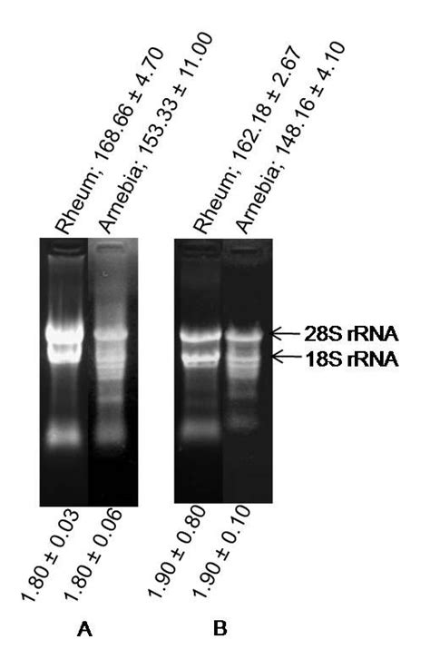 Denaturing Gel Electrophoresis Of Rna Isolated From Leaf Tissues Of Download Scientific Diagram