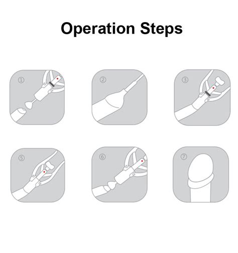 Bloodless Procedure Disposable Circumcision Stapler With Zero