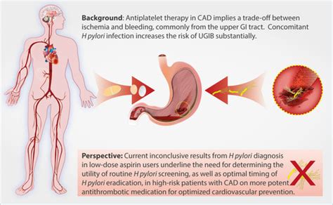 Time For Routine Helicobacter Pylori Screening In Coronary Artery