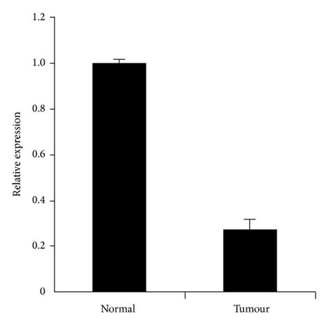 Nell 1 MRNA Expression Analysis Quantitative Polymerase Chain Reaction