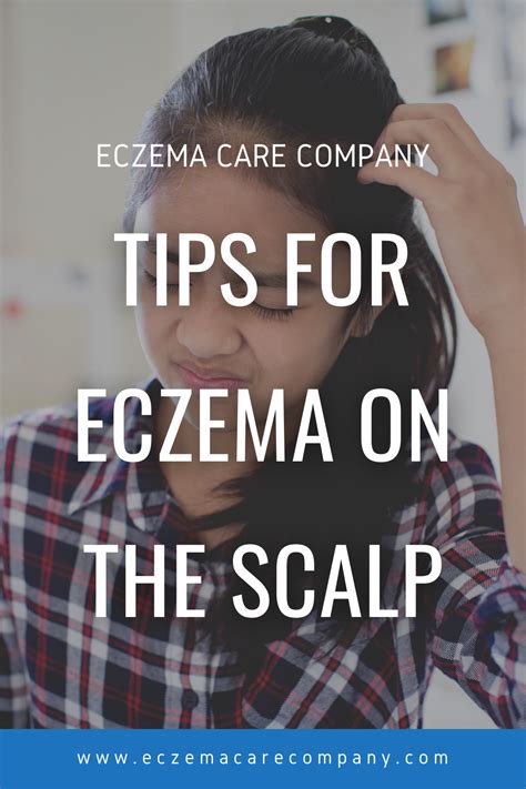 Tips For Eczema On The Scalp Artofit