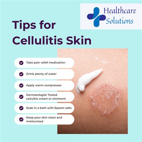 Tips For Cellulitis Skin Rskincarerehab