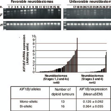 Expression Levels Of Kif B In Primary Neuroblastomas A