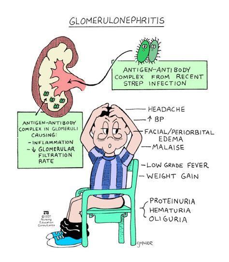 Glomerulonephritis Nclex Rn Med Surg Nursing Pediatric Nursing