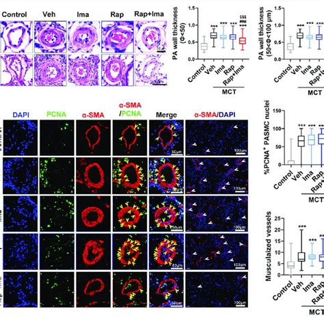 Rapamycin Combined With Imatinib Attenuates Ph Induced By