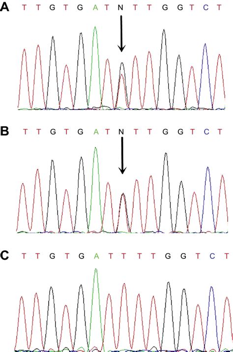 Mutation of the KIT gene. Notes: (A) The proband's KIT genomic sequence ...