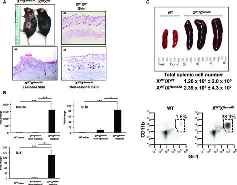 Nonubiquitinatable Nemo Knockin Mice Develop Inflammatory Skin Lesions Download Scientific