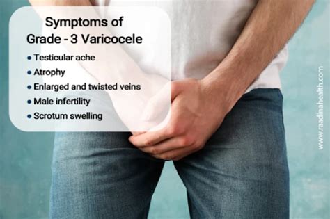 Varicocele Pg Urology Yorkshire