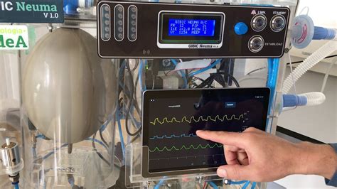 Modo Asistido Controlado por Presión en el Ventilador GIBIC Neuma V1 0