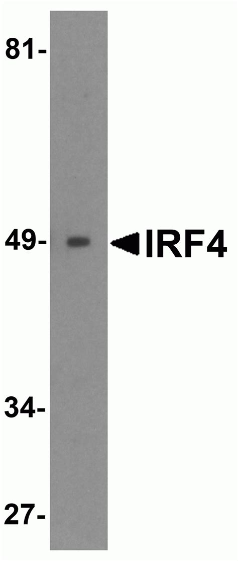 irf antibody cat   prosci