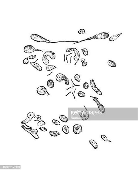 Tuberculosis Microscope Photos and Premium High Res Pictures - Getty Images