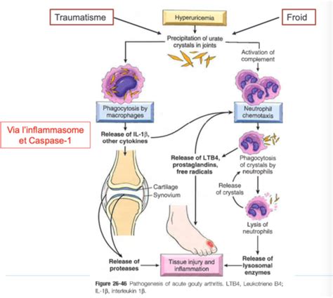 Cours N3 Goutte Et Arthropathies Microcristallines Flashcards Quizlet