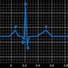 Qué es un electrocardiograma y para qué sirve Para qué es utilizado un