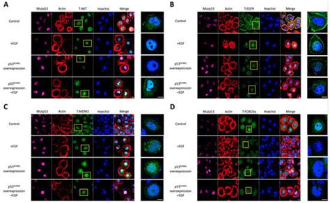 Gain Of Function Mutant Tp R Q Overexpressed In Epithelial Ovarian