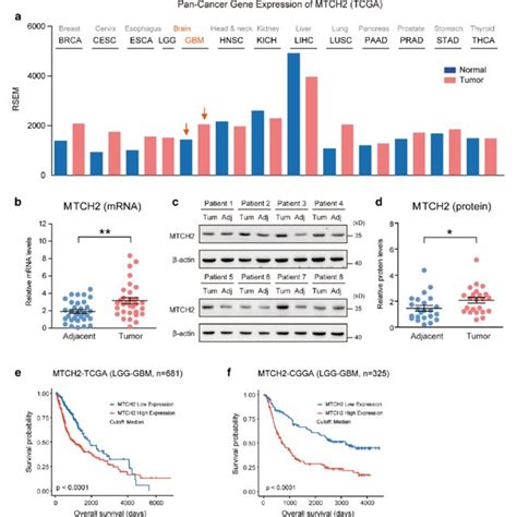 Mtch Expression Is Increased In Glioma Tissues And Indicates Poor