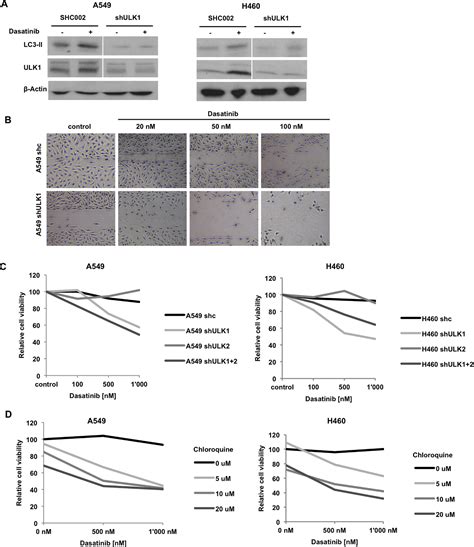 Microrna 106a Targets Autophagy And Enhances Sensitivity Of Lung Cancer