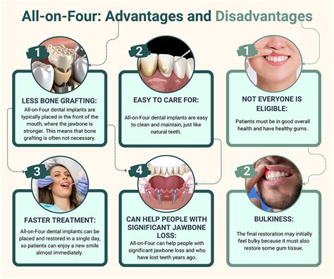 All-on-4 Dental Implants NJ | All on Four Implants in Bergen County