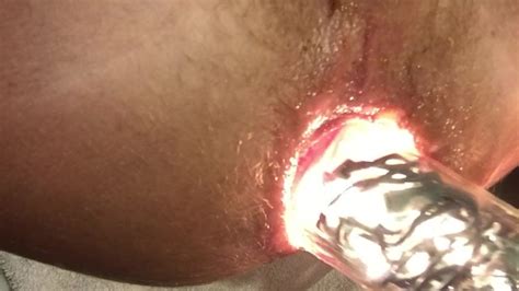 Lighting Up My Ass Pornhub Gay